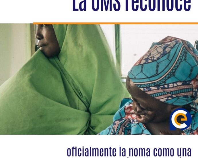 La OMS reconoce oficialmente la noma como una enfermedad tropical desatendida