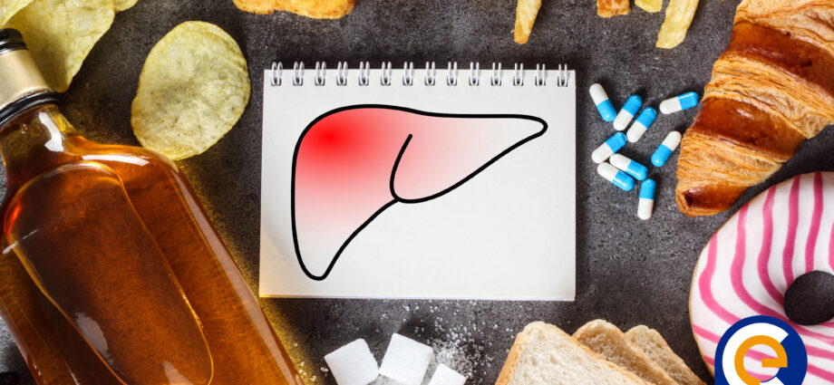 Reconoce las señales de un hígado sobrecargado