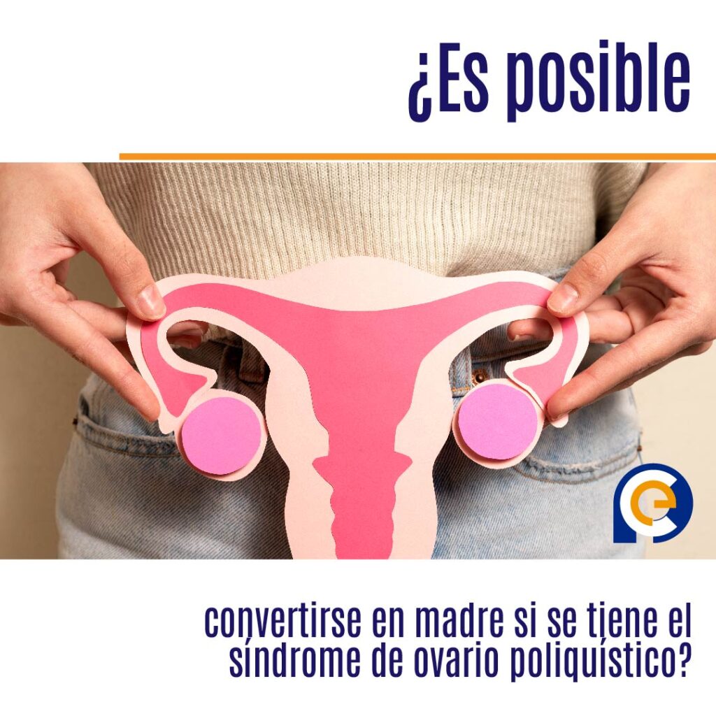 ¿Es posible convertirse en madre si se tiene el síndrome de ovario poliquístico?