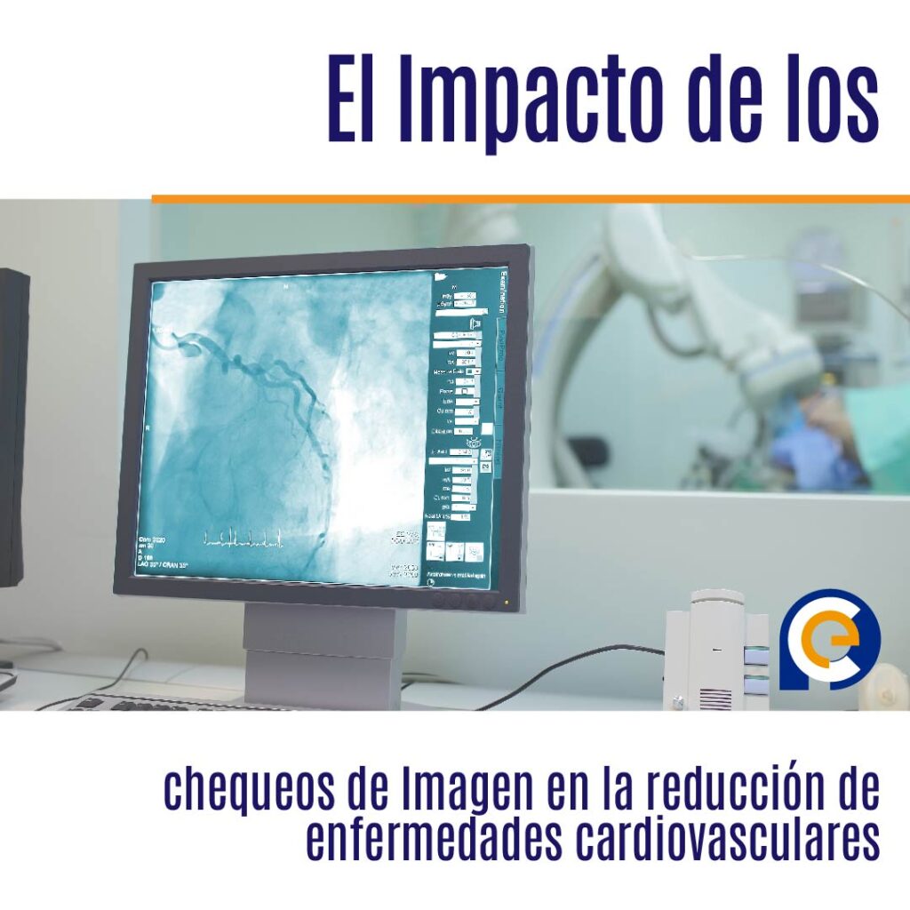 El Impacto de los chequeos de Imagen en la reducción de enfermedades cardiovasculares
