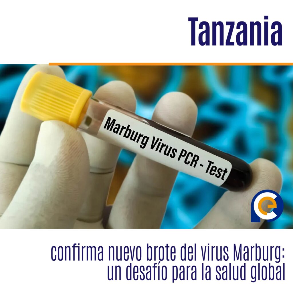 Tanzania confirma nuevo brote del virus Marburg: un desafío para la salud global