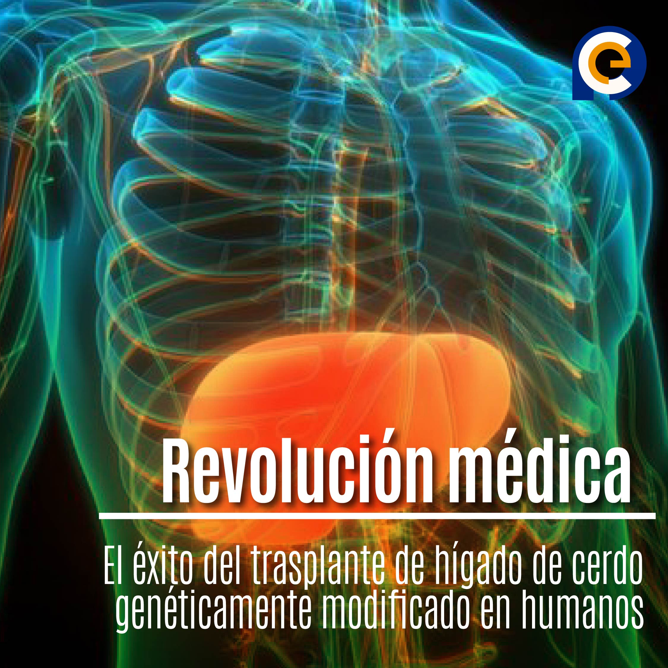 Revolución médica: el éxito del trasplante de hígado de cerdo genéticamente modificado en humanos